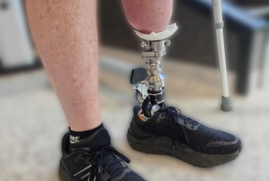 osseointegration1