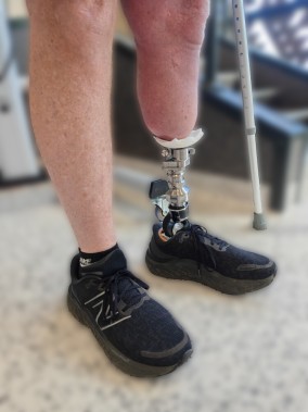 osseointegration1