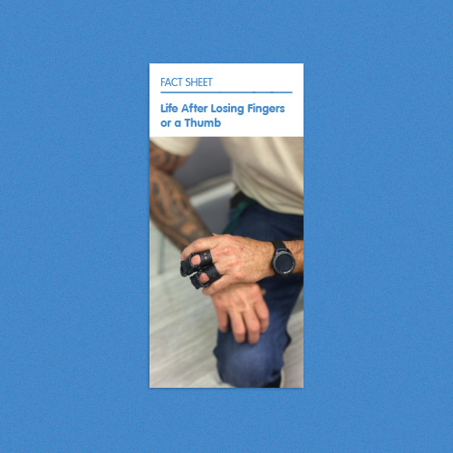 Read about the types of prosthetic options available for finger and hand amputations.